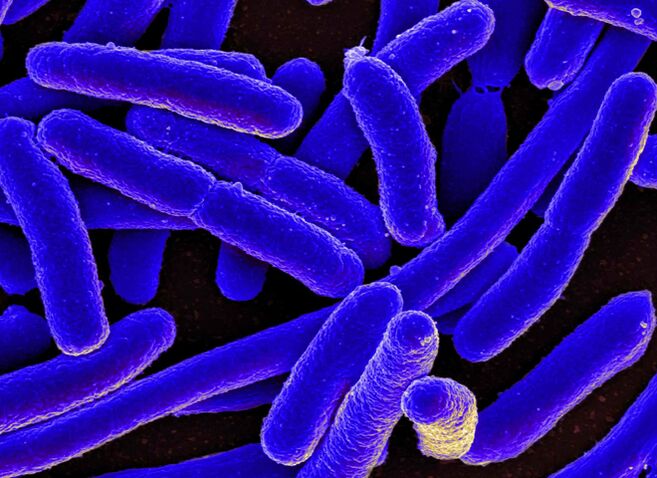 E. coli dažniausiai provokuoja cistito vystymąsi moterims